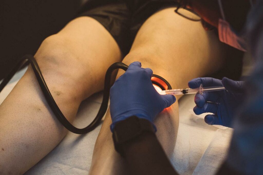 SCLEROTHERAPY - WHAT YOU NEED TO KNOW - FSA